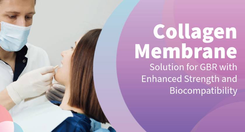 Addressing Clinical Challenges in GBR with Resorbable Collagen Membranes